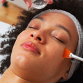 Skin Savvy USA: Chemical Peels For Beautiful You