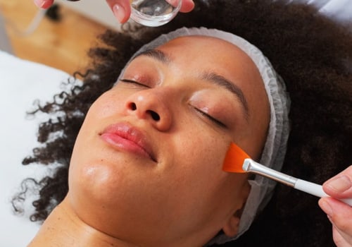 Who Should Get a Chemical Peel? A Comprehensive Guide