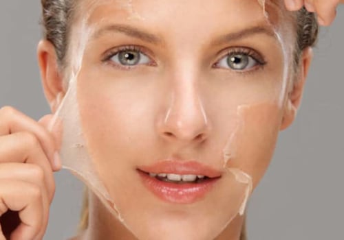 Which Chemical Peel is Best for Sensitive Skin?